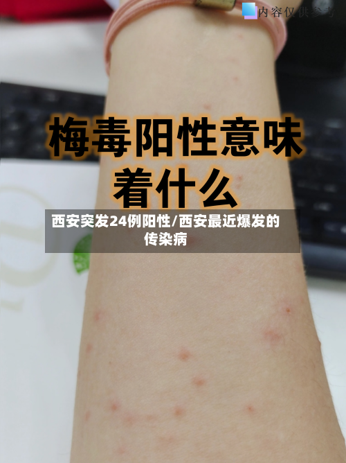 西安突发24例阳性/西安最近爆发的传染病-第1张图片