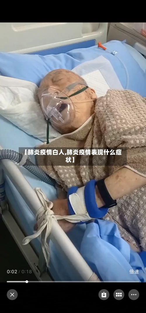 【肺炎疫情白人,肺炎疫情表现什么症状】-第1张图片