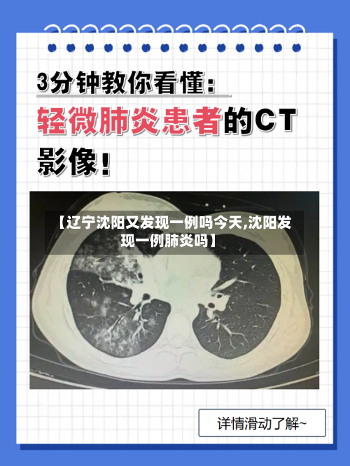 【辽宁沈阳又发现一例吗今天,沈阳发现一例肺炎吗】-第1张图片