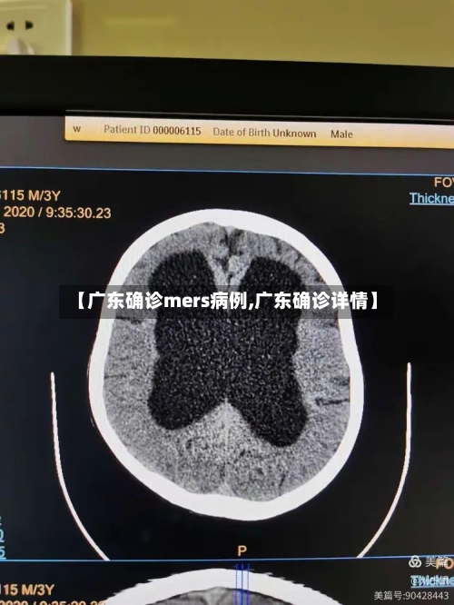 【广东确诊mers病例,广东确诊详情】-第1张图片